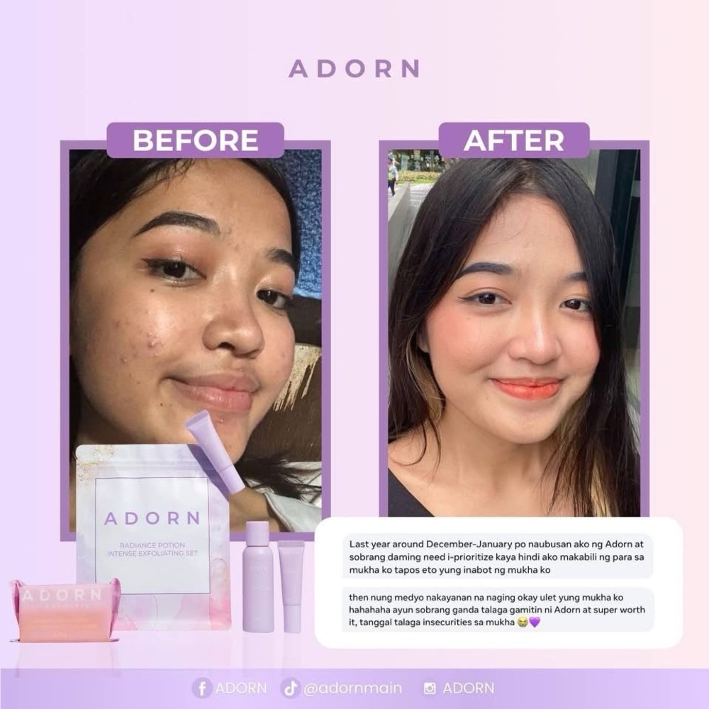 Adorn Rejuvenating Skincare Set - Picture 4 of 12